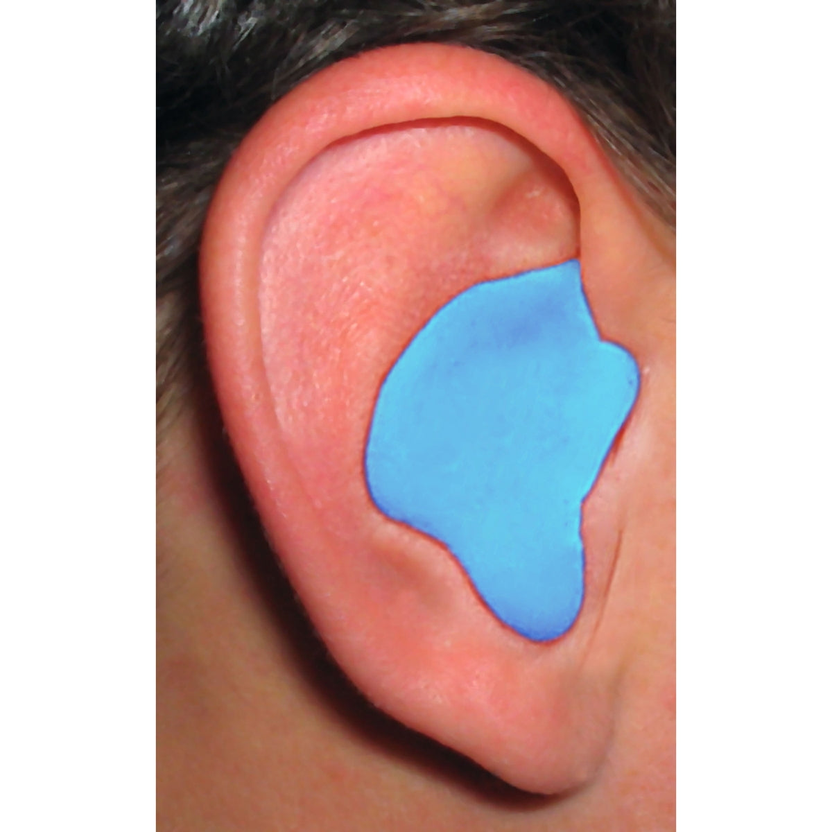 Blue Ear Plugs - Radians - Custom Molded Fit